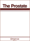 PROSTATE